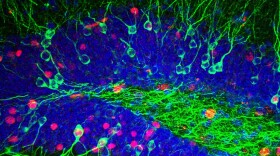 Researchers can currently observe small groups of neurons firing in real-time. But they're hoping to get bigger pictures by developing better brain imaging technology through the BRAIN initiative.