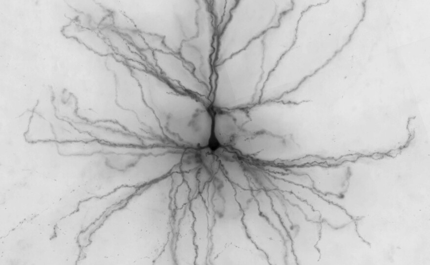 Researchers injected dye into this human neuron to reveal its shape.