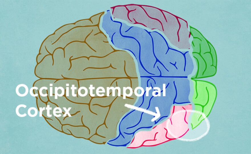The occipitotemporal cortex