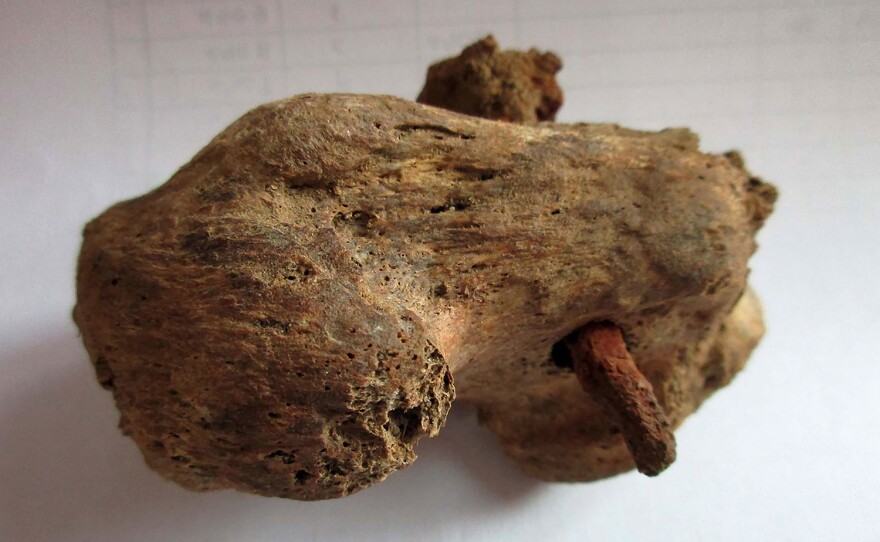 Heel bone