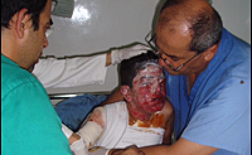 Doctors treat Mahmoud Surour, whose face and chest were badly burned in an airstrike yesterday in Tyre. Surour was evacuated from Tyre on Monday by a ship from Cyprus.