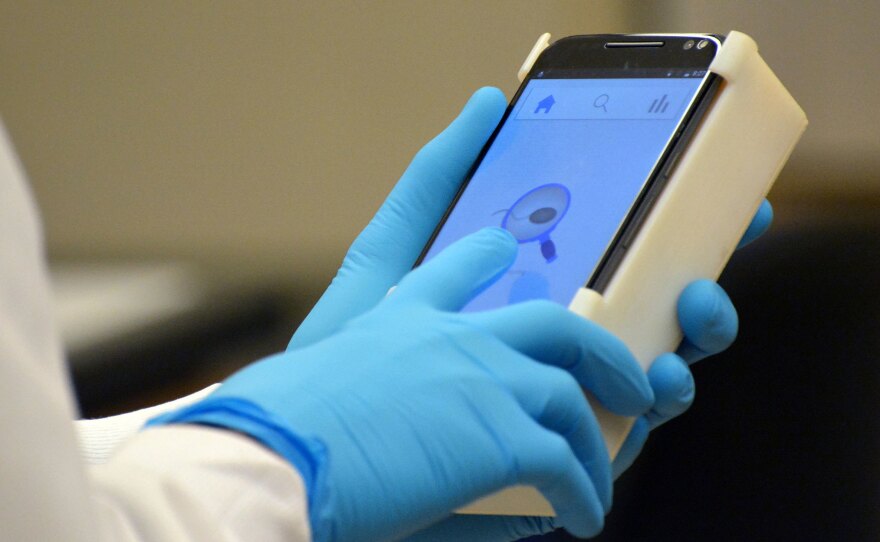 Scientists have developed a smartphone app to measure sperm count at home.