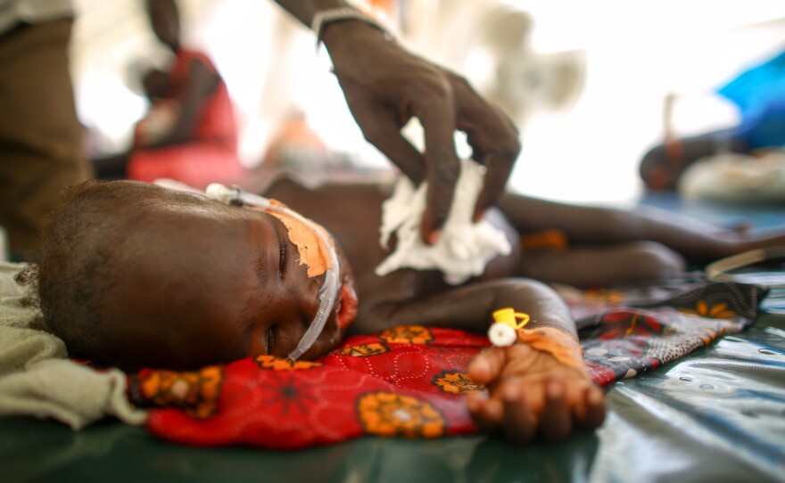 A 3-year-old who weighs only 15 pounds is suffering from severe malaria. Here she is wiped down with a damp cotton pad to cool her off. She died a week after being admitted.