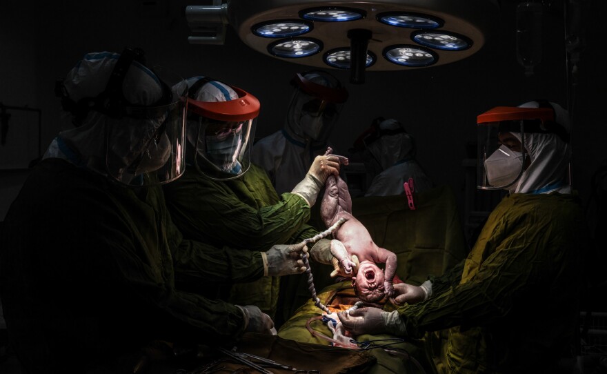 Dr. Agnes Bernabe and her team deliver a baby by cesarean section at the Nueva Vizcaya Provincial Hospital on August 18. "As a doctor who knows the risks, I will not advocate for a home birth," says Bernabe.