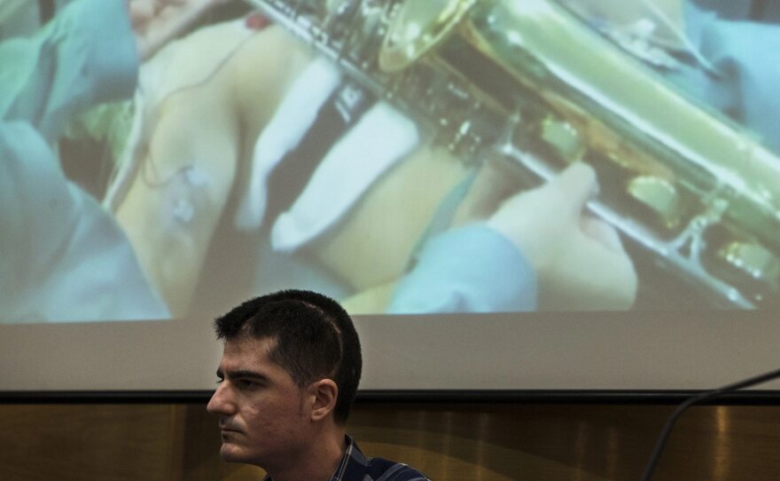 Carlos Aguilera recently discussed how he played the saxophone during surgery to remove a brain tumor at Regional Hospital of Malaga, in Andalusia, Spain.