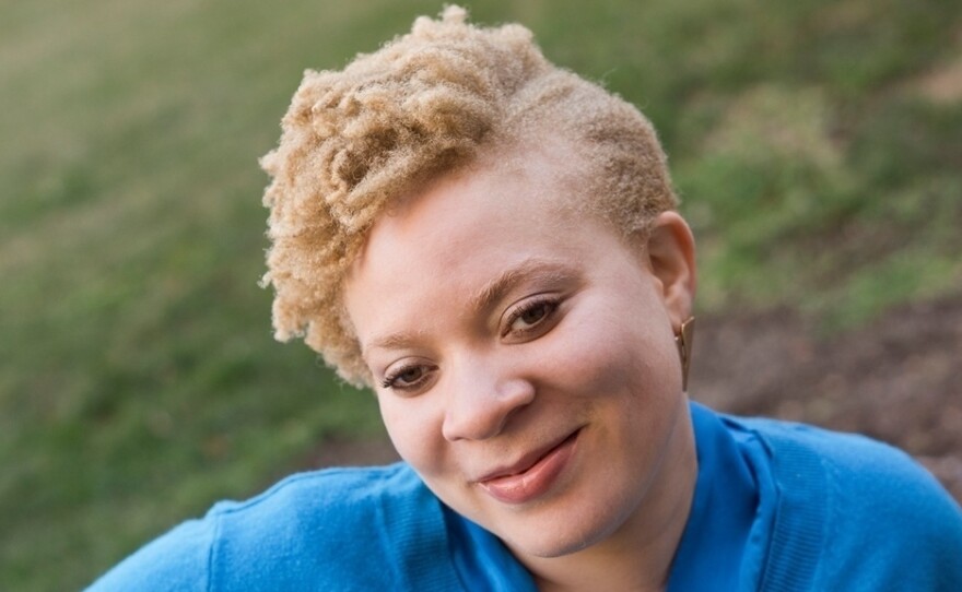 Brandi Green negotiates the world as an African American woman with albinism.