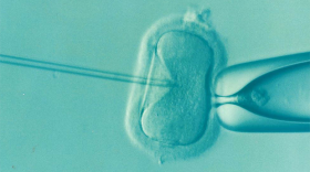IVF example