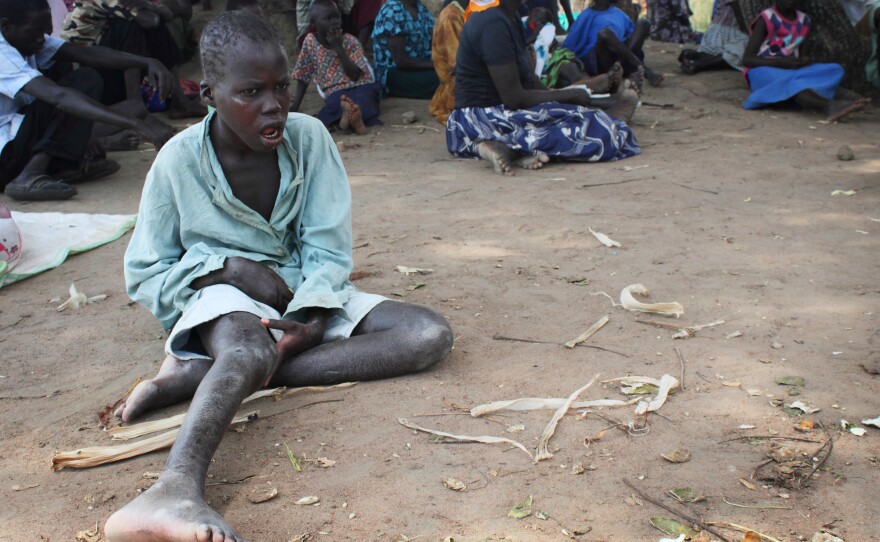 A child with nodding syndrome waits for treatment at an outreach site in Uganda's Pader district.