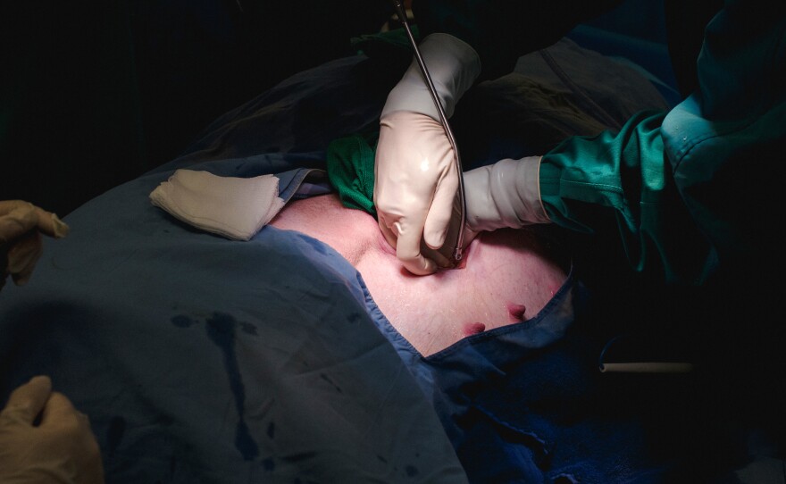 Dr. Christoph Haller performs surgery to remove a fetal pig from the adult pig's womb.