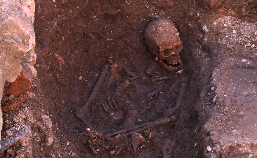 The remains of King Richard III, found in an archaeological dig in Leicester, England, revealed a twisted spine.
