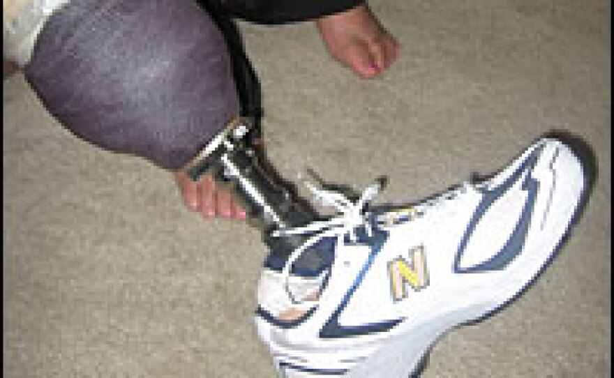 Brumley's left leg was amputated nine inches below his knee. He asked his prosthetist to make him a foot that would allow him to surf.