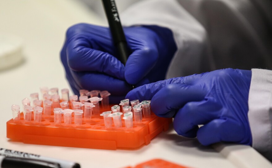 A scientist at work on a COVID-19 vaccine candidate at Bogazici University in Istanbul in August.