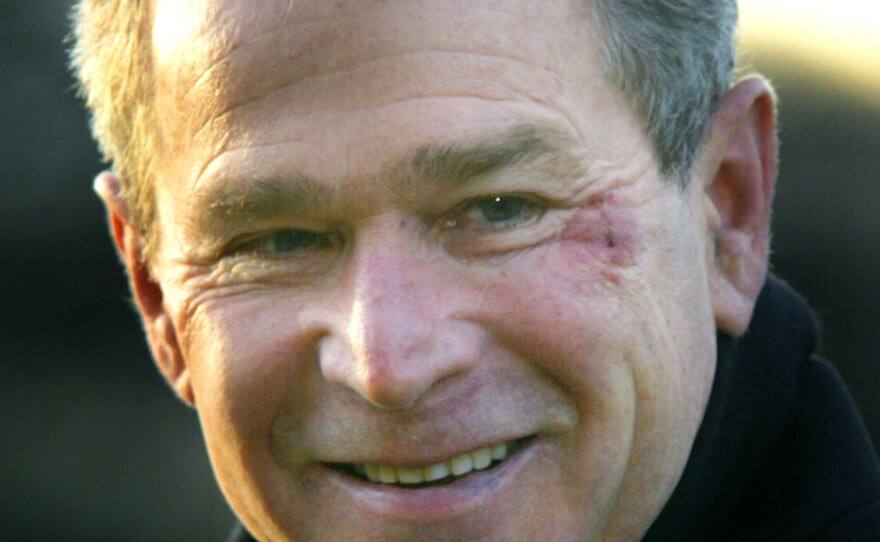 In 2002, former President George W. Bush apparently choked on a pretzel while watching a football game, briefly lost consciousness and was bruised from falling to the floor from a couch.