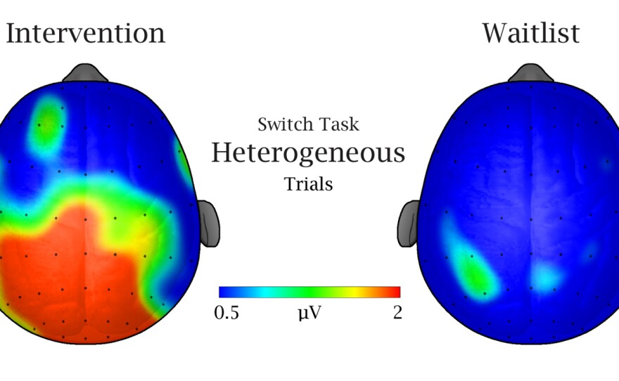 Brain activity during the multitasking test for active kids (left) and non-active kids (right). Red indicates more activity, blue indicates less.