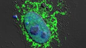 This is a confocal fluorescence microscopy image of NLRX1 (green) in a HeLa cell (blue, nuclear stain).
