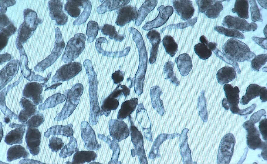 A microscopic view of the worms that cause schistosomiasis, taken on August 20, 2015.