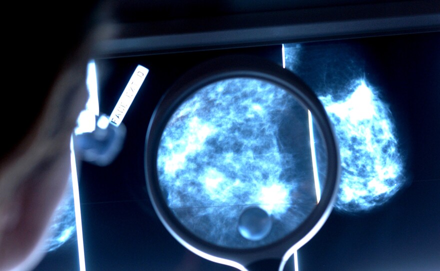 When do women get the most benefit from mammograms to find breast cancer?