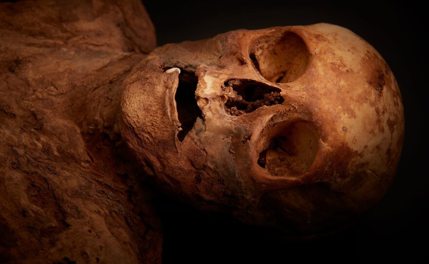 The mummy, now identified as Anna Catharina Bischoff, was discovered in 1975. But it appears that wasn't the first time it was unearthed; researchers now believe the body was also found in 1843.
