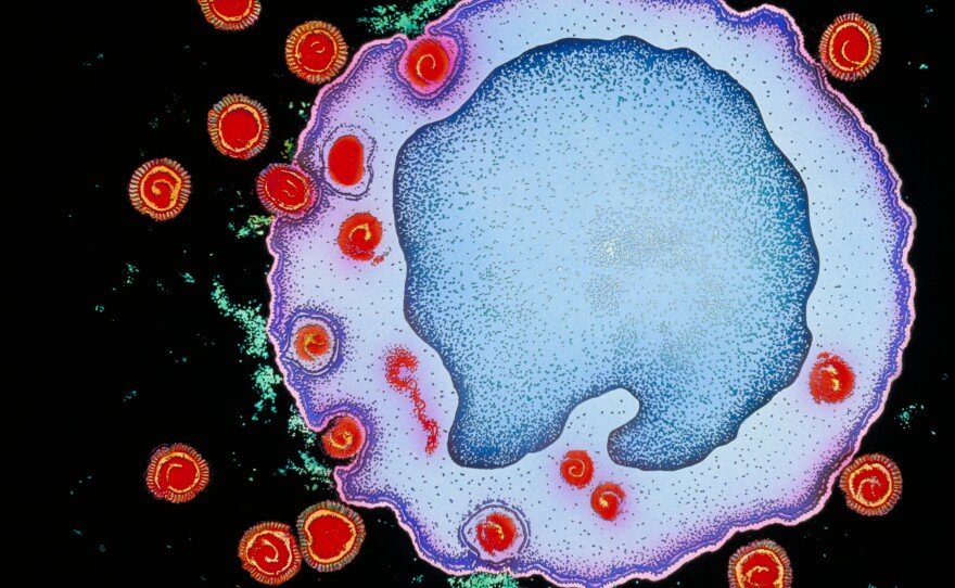 HIV particles (red) invade a human immune cell. When HIV is transmitted through sex, only the strongest establish long-term infection.