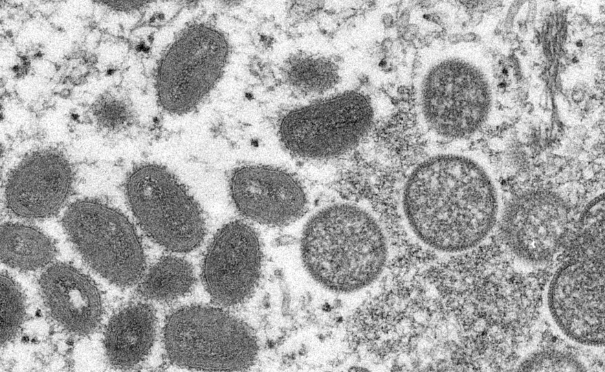 This 2003 electron microscope image made available by the Centers for Disease Control and Prevention shows mature, oval-shaped monkeypox virions, left, and spherical immature virions, right, obtained from a sample of human skin associated with the 2003 prairie dog outbreak.