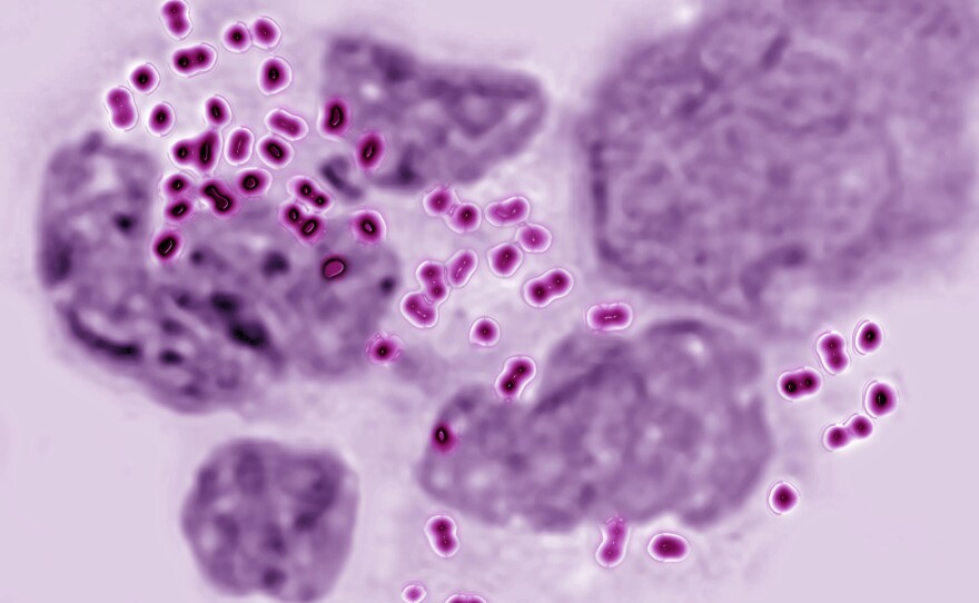 A microscope image, magnified 600 times, of the bacteria that cause the sexually transmitted disease gonorrhea.