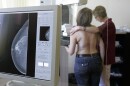 In this April 16, 2007, file photo X-ray technician Martina Rosenow, right, and assistant medical technician Marianne Warnholz, demonstrate a mammogram screening process in Berlin.