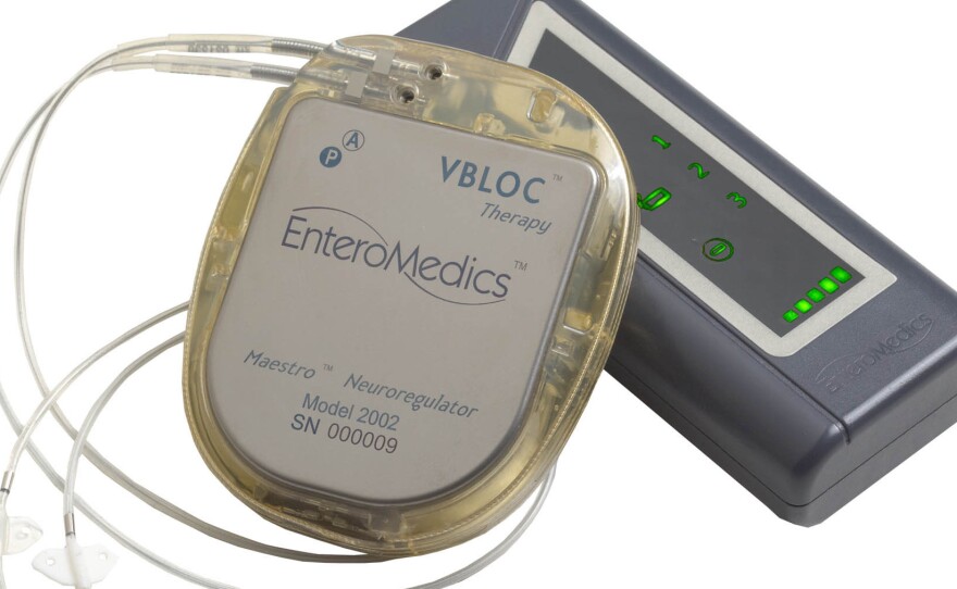Electrical impulses generated by a pacemaker-like device are transmitted to the vagus nerve by electrodes.