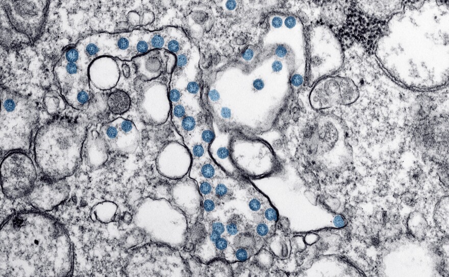 This 2020 electron microscope image made available by the U.S. Centers for Disease Control and Prevention shows the spherical particles of the new coronavirus, colorized blue. New York is planning a major effort to test the population for antibodies for the coronavirus as a key to deciding whether to reopen the economy.
