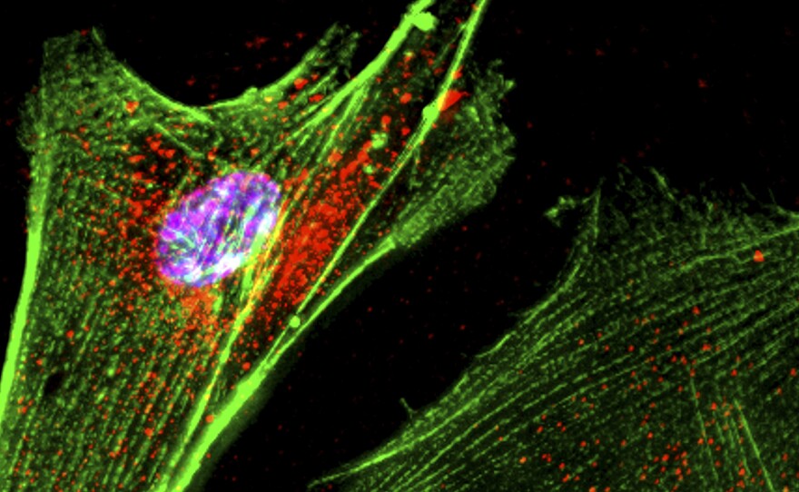 When the neurons that release the neurotransmitter dopamine die, people develop Parkinson's disease.