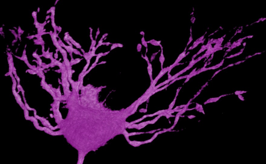 A 3-D reconstruction of a healthy auditory neuron from a chick.