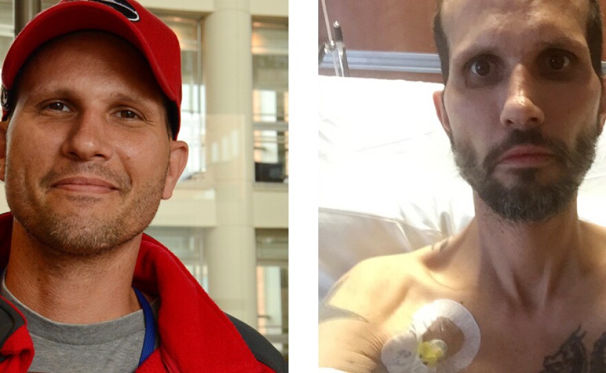 Kris Penny in April (left), and in October.