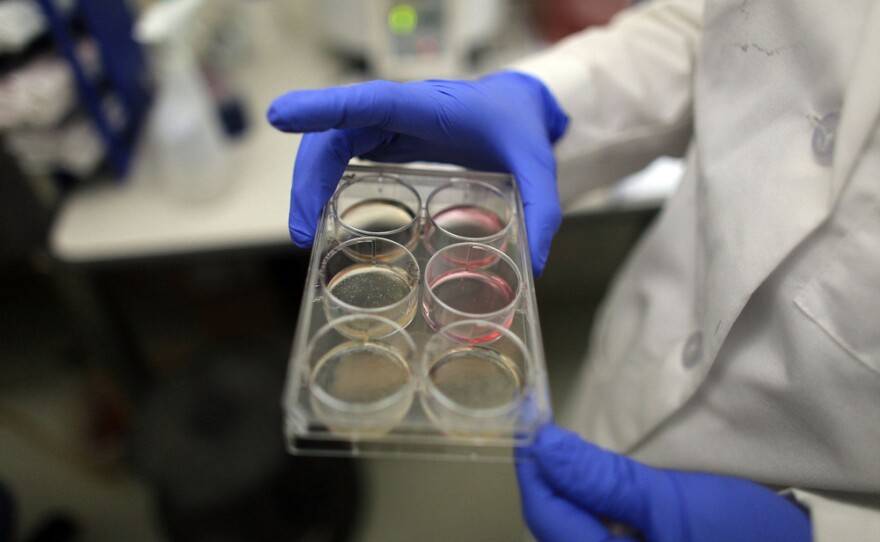 A scientist holds a tray of stem cells in a lab, in this file photo from 2010.
