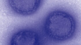 Colorized influenza A virus.