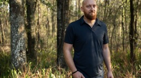 Wade Hanicker poses for a portrait at his home in Brooksville, Fla., on March 23, 2026. Hanicker was diagnosed with silicosis after years of cutting quartz countertops.