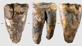 Several views of the molar tooth archeologists discovered in Chagyrskaya Cave.
