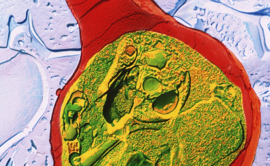 A colored microscope image of the malaria parasite, <em data-stringify-type="italic">Plasmodium sp.</em> (green), infecting a red blood cell (red). Malaria is spread from infected <em data-stringify-type="italic">Anopheles</em> mosquitoes to people. The parasites infect the liver, then move into the blood.