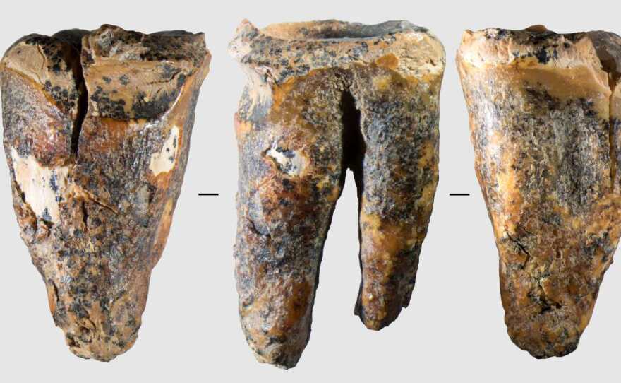 Several views of the molar tooth archeologists discovered in Chagyrskaya Cave.