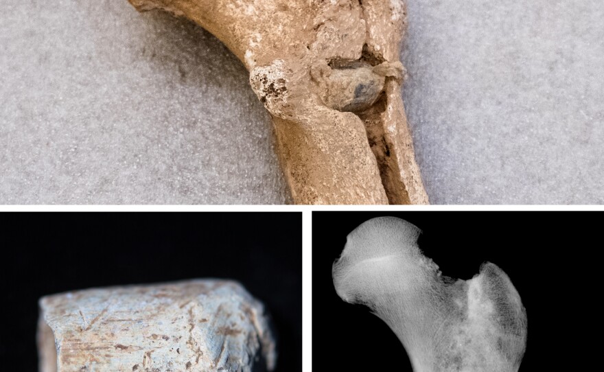 (Top) A bullet lodged in the femur of one of the skeletons. (Lower left) An Enfield bullet from that time period, shows the shape and size of the kind of bullet that killed the soldier. (Lower right) An X-ray shows the position of the embedded bullet in the femur.