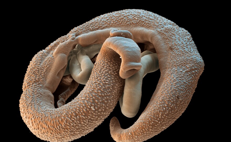 A male and female pair of Schistosoma parasites.