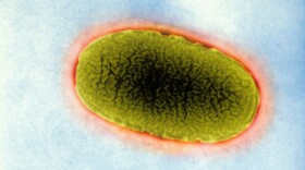 Klebsiella pneumoniae, seen here with an electron microscope, are the most common superbugs causing highly drug-resistant infections in hospitals.