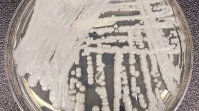 This is a strain of Candida auris cultured in a petri dish at a laboratory at the Centers for Disease Control and Prevention. It's a form of yeast that can harm humans — and is resistant to the most common antifungal drugs.