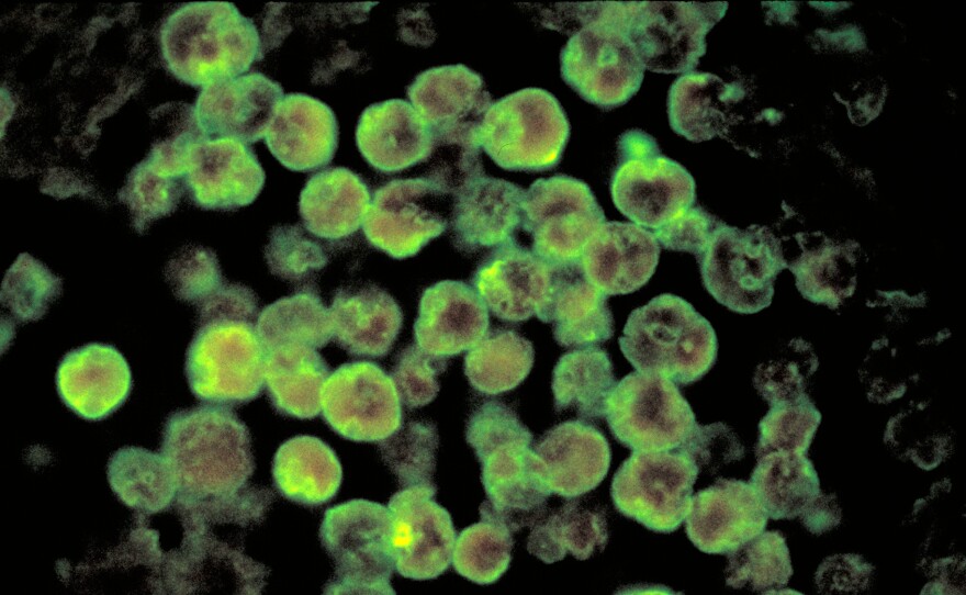 The amoebas that can cause rare brain infections resemble white blood cells under the microscope.