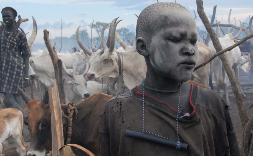 This young herder has lots of protection. The ash on his face isn't just decorative; it keeps away flies. The filter in his pipe removes tiny crustaceans carrying Guinea worm larvae from drinking water.