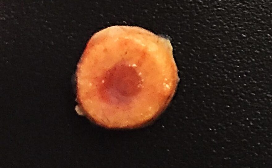 A bone transplant developed by researchers at UC San Diego is seen in this undated photo.