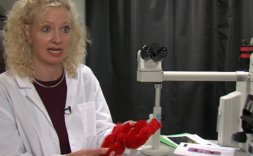 Dr. Christina Sigurdson shows a model of a misshapen protein that's characteristic of mad cow disease and other degenerative brain disorders that affect both animals and people.