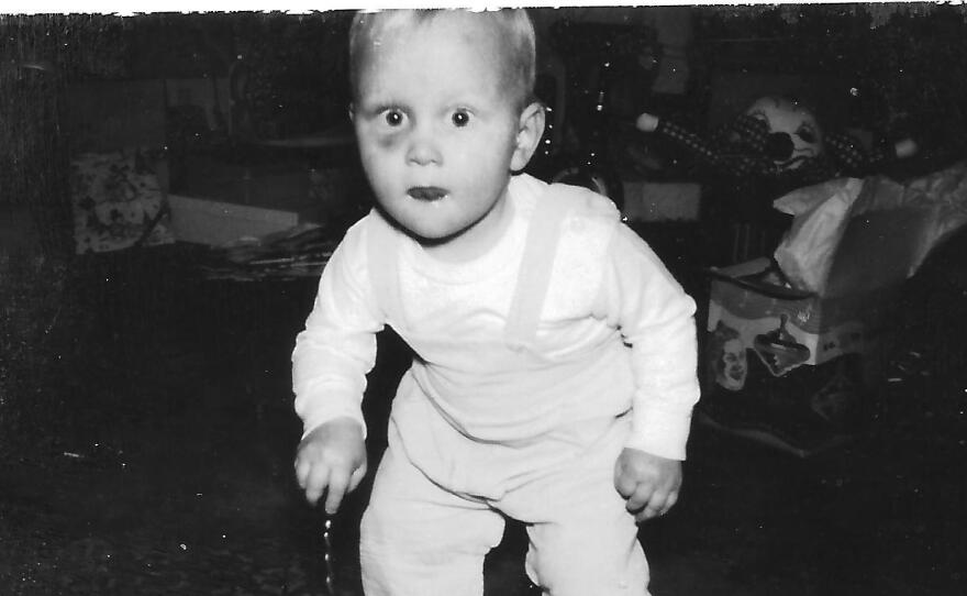 Sporting a shiner wasn't all that unusual for Randy Curtis at age 2. The bleeding disorder he inherited prompted frequent bruising.