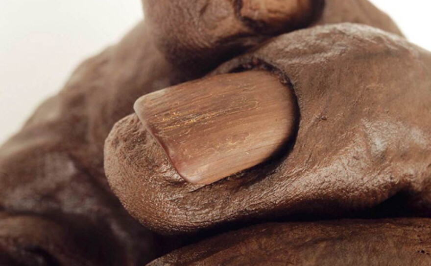 Close-up of Old Croghan Man's hand showing the remarkable preservation of the skin and nail.