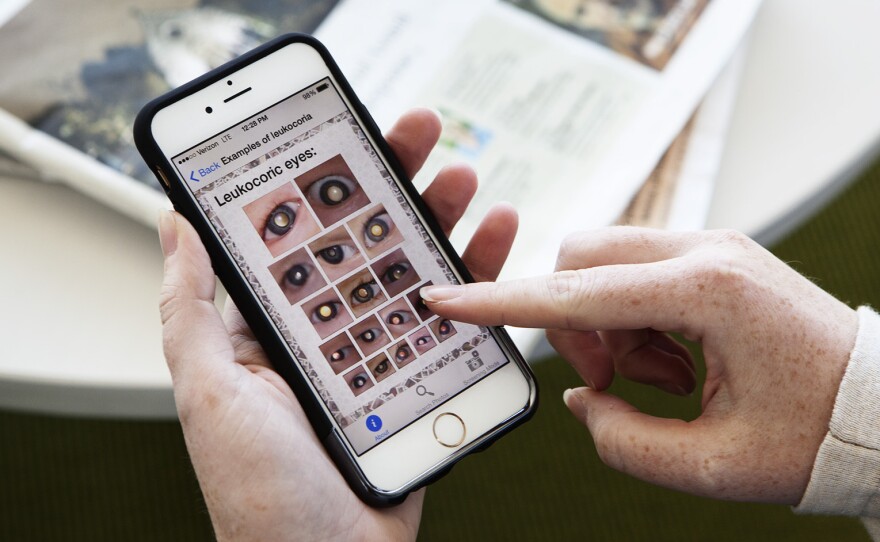Examples of what the iphone app looks for: The white reflection from an otherwise dark pupil can indicate a tumor, a cataract, or other eye problems.