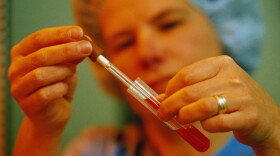 A technician places a fertilized human egg in a test tube. New technology has led to new legal questions: What happens to survivors benefits when a baby is conceived after a father's death? 