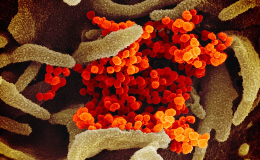 In this image from a scanning electron microscope, the new coronavirus is in orange.